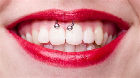 The Truth About Smiley Piercings